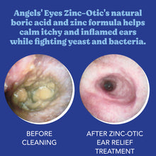 Load image into Gallery viewer, Angels&#39; Eyes Zinc-Otic Ear Relief Treatment
